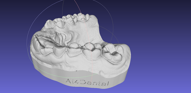 Modèle de travail pour mes prothèses en orthodontie créé en 3D par EasyModel